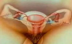 Espermas entrando no útero da mulher